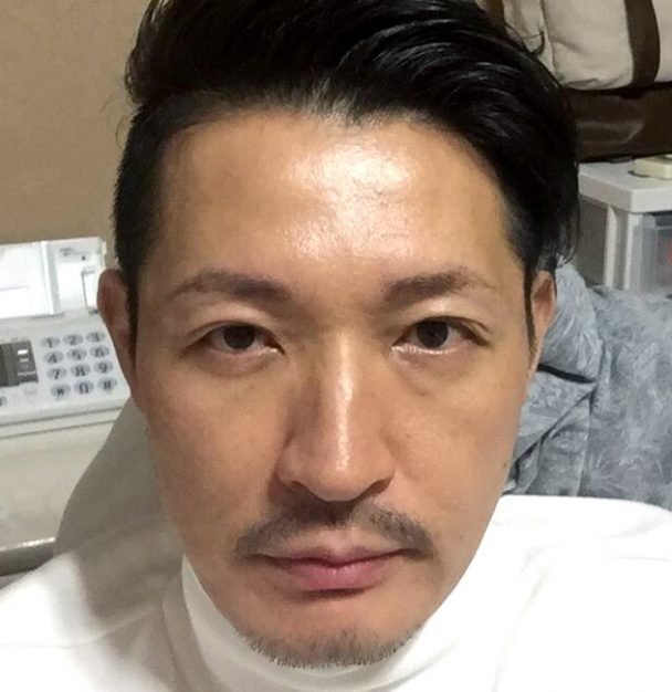 術後写真