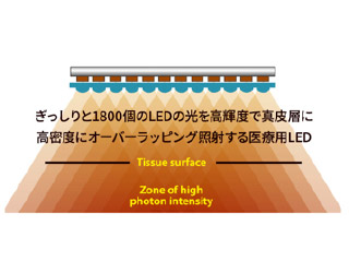 ヒーライトの効果