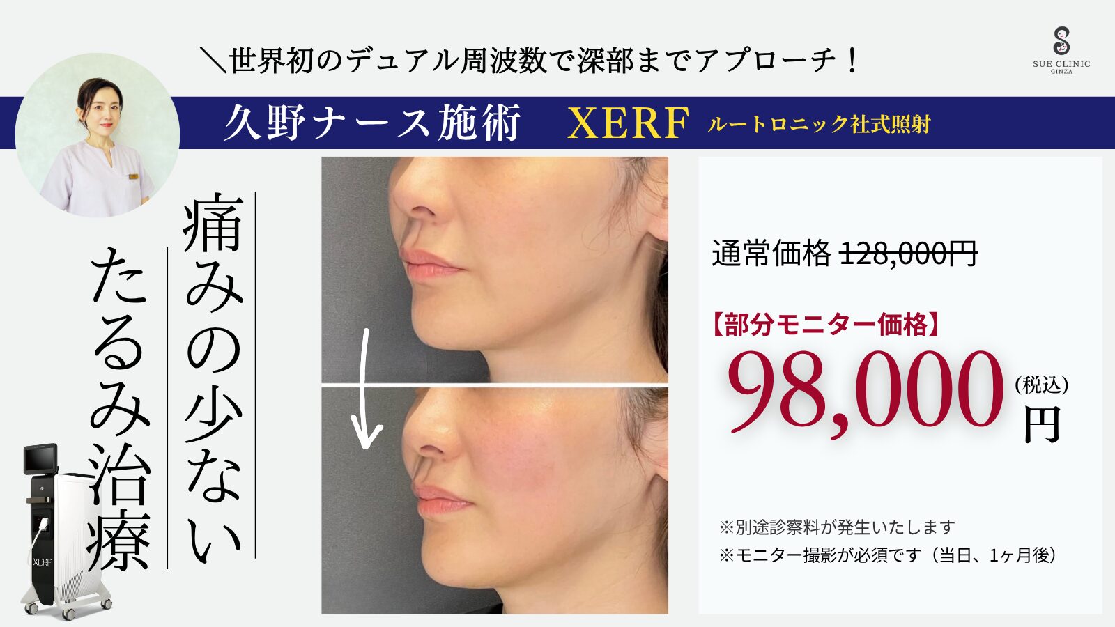 【久野ナース施術】XERF(ザーフ)