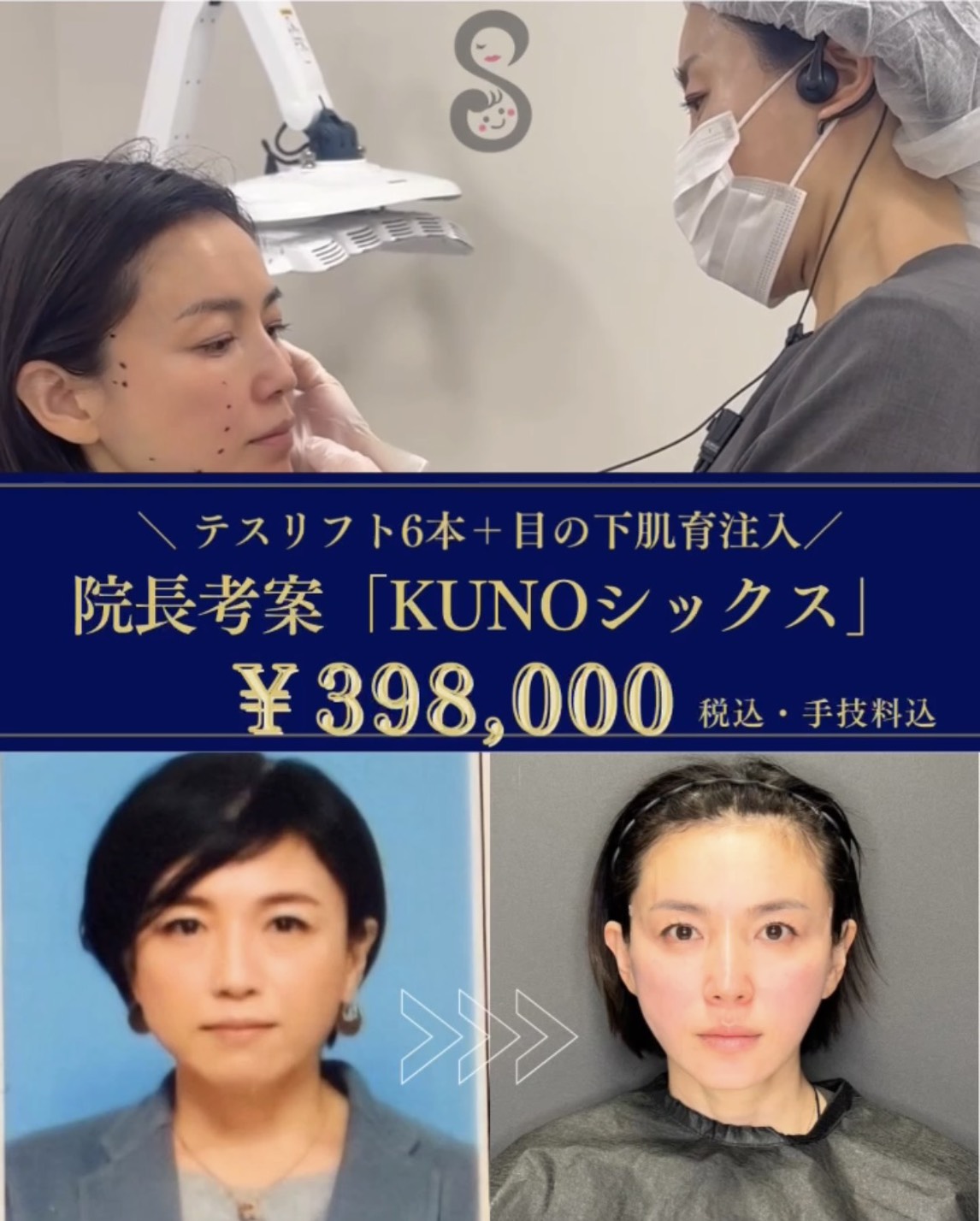 5月限定キャンペーン