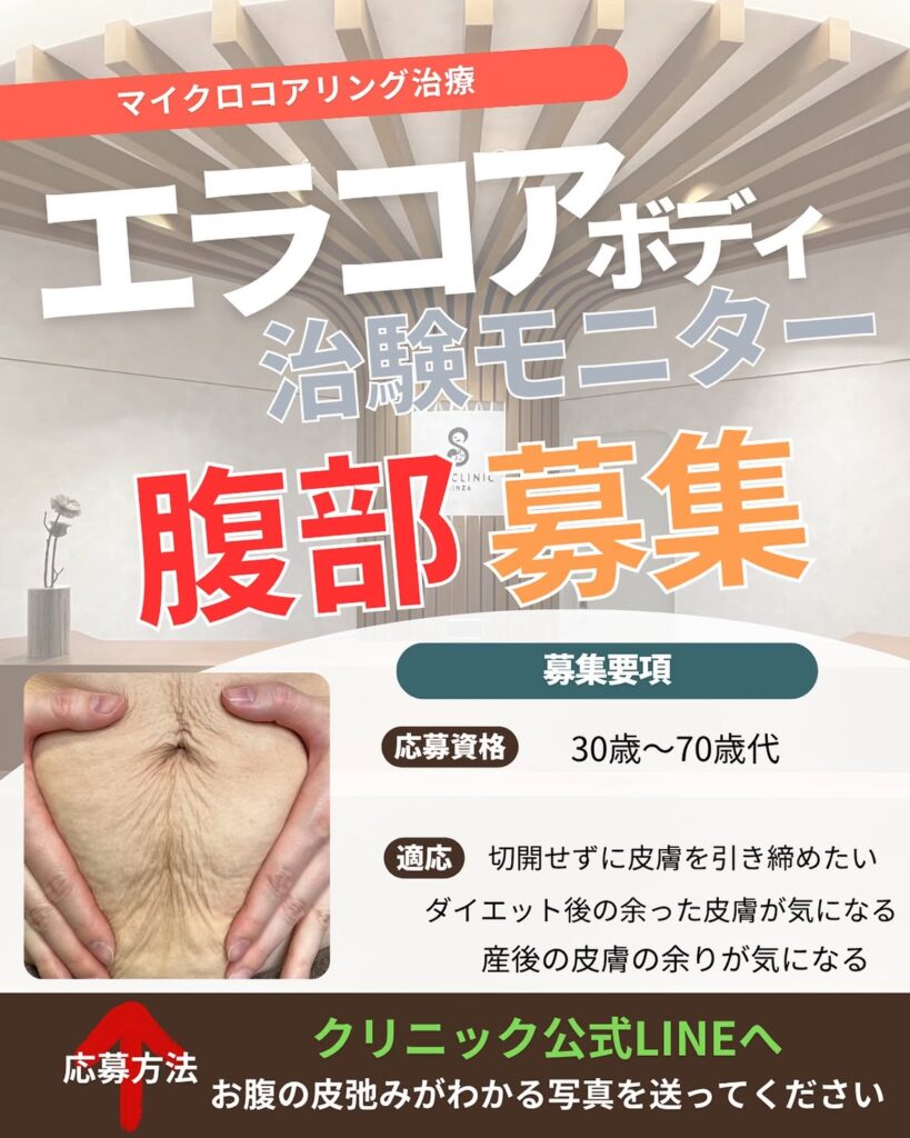 エラコア腹部モニター