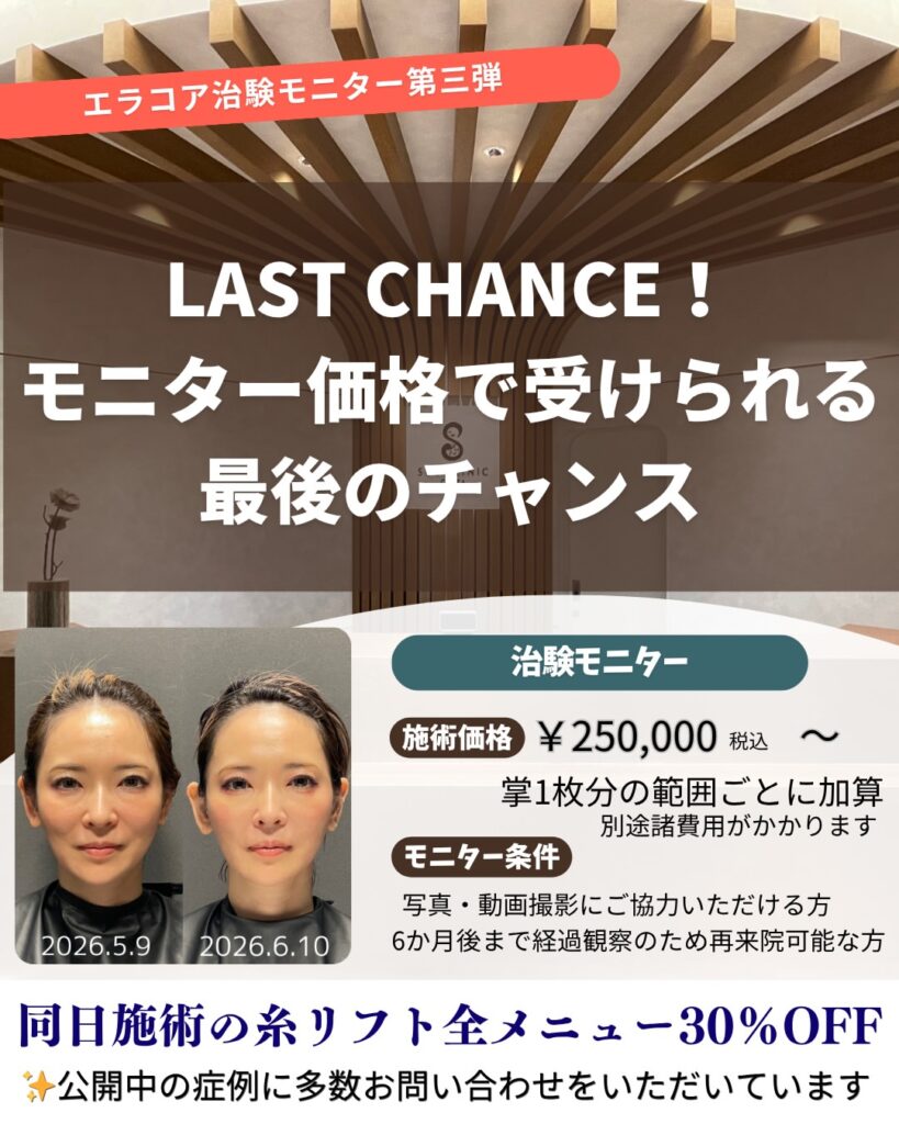 モニター価格