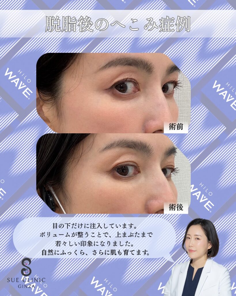 症例