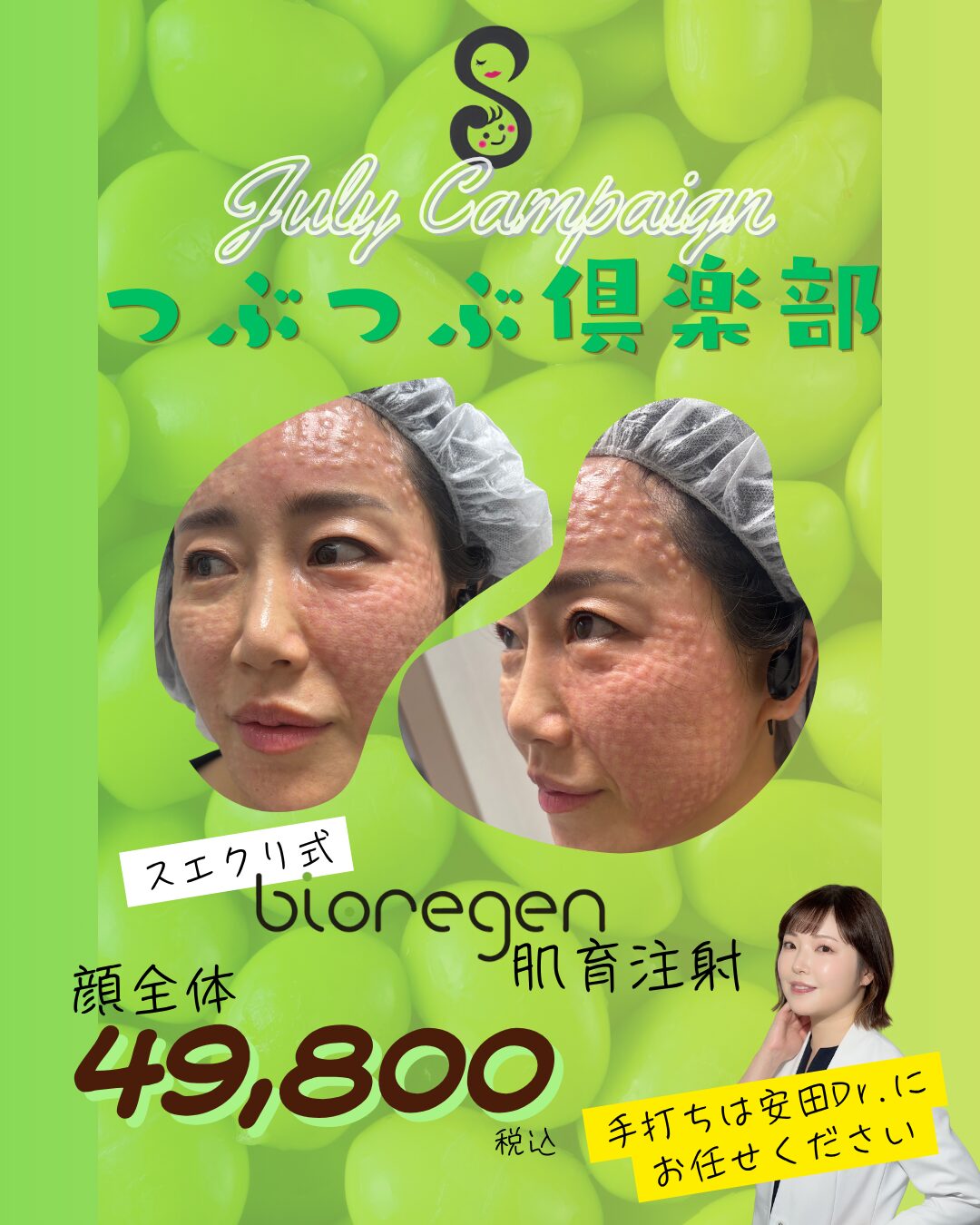 7月🫘つぶつぶ俱楽部🫘安田医師キャンペーン