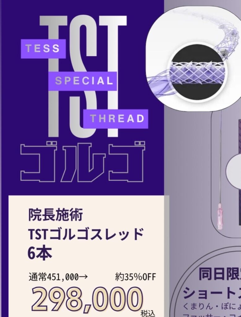 TSTゴルゴ