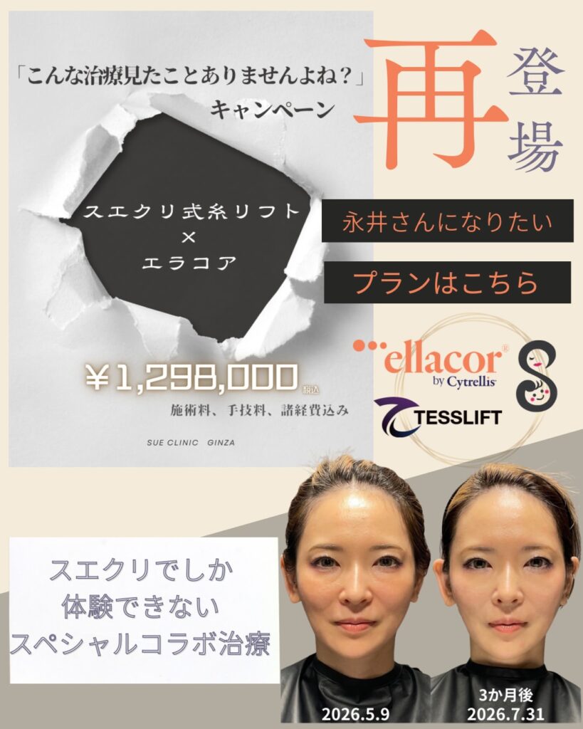 SUEクリ式治療