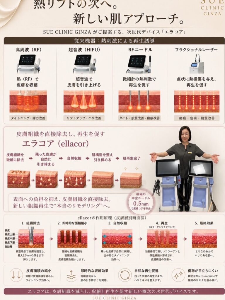 エラコアについて