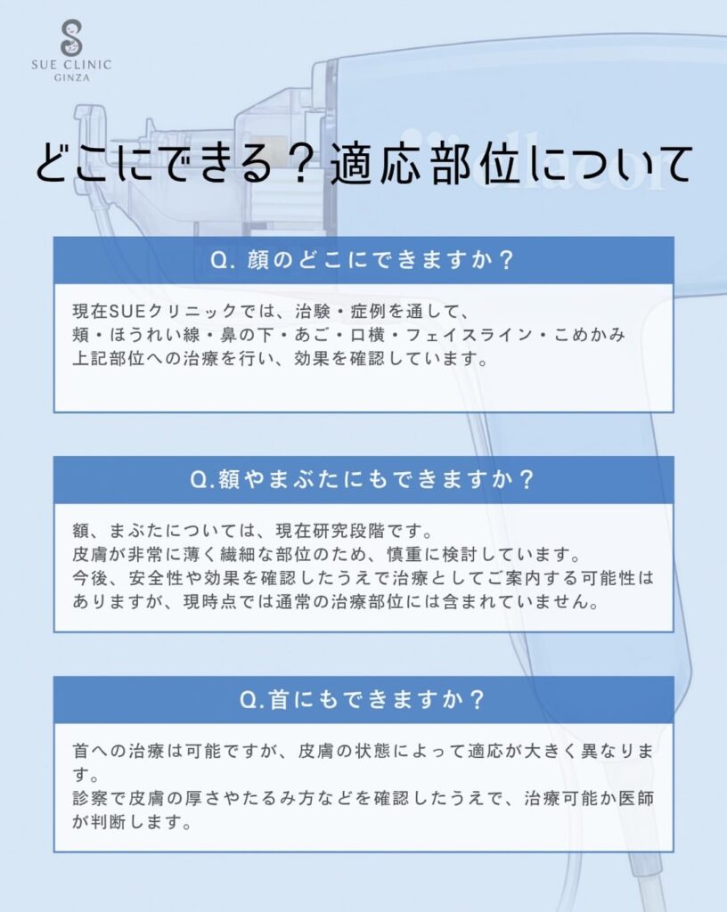 適用部位について