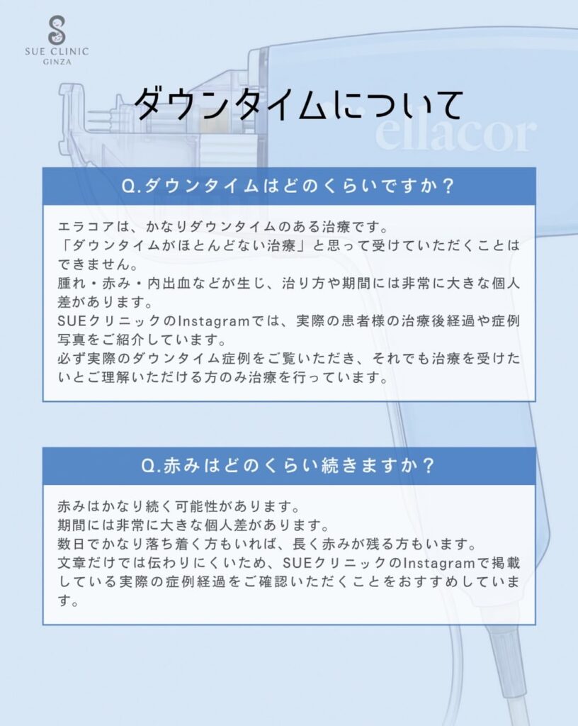 エラコアダウンタイム