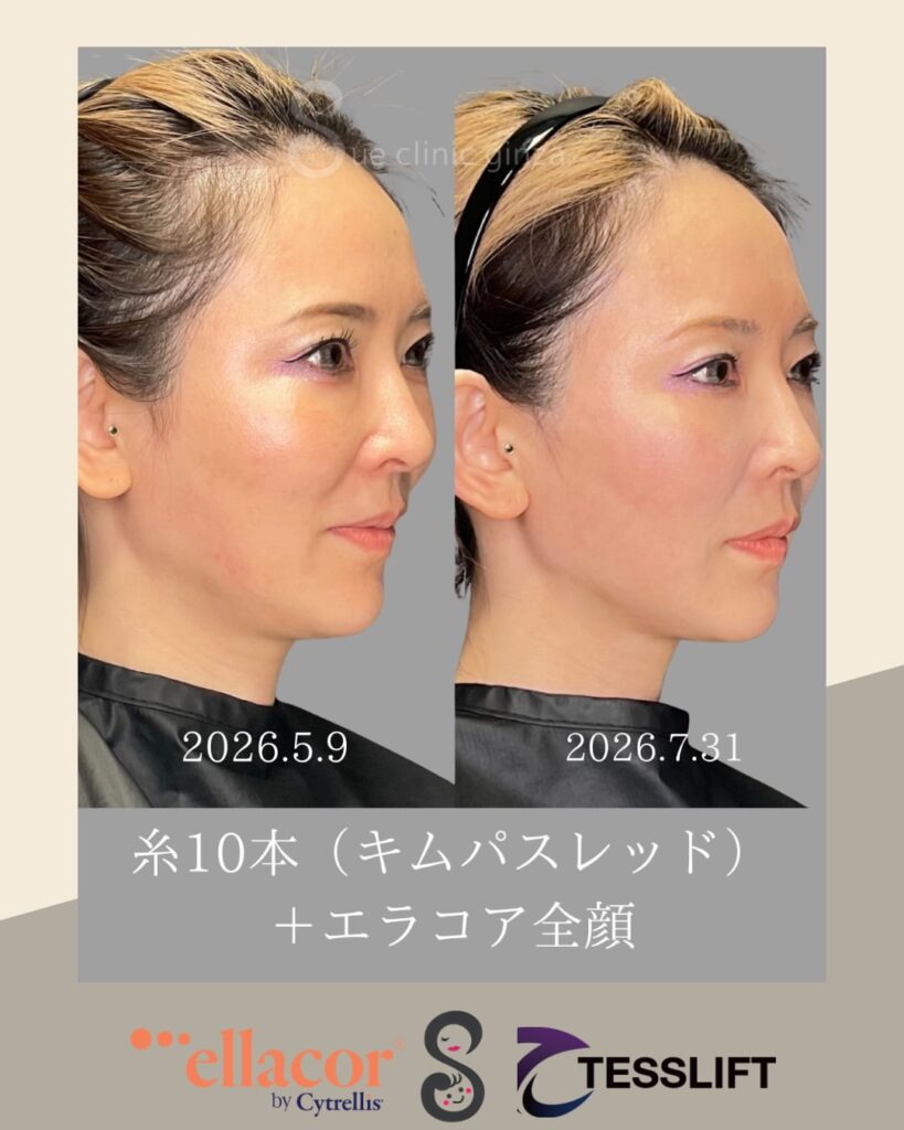 スペシャルコラボ治療
