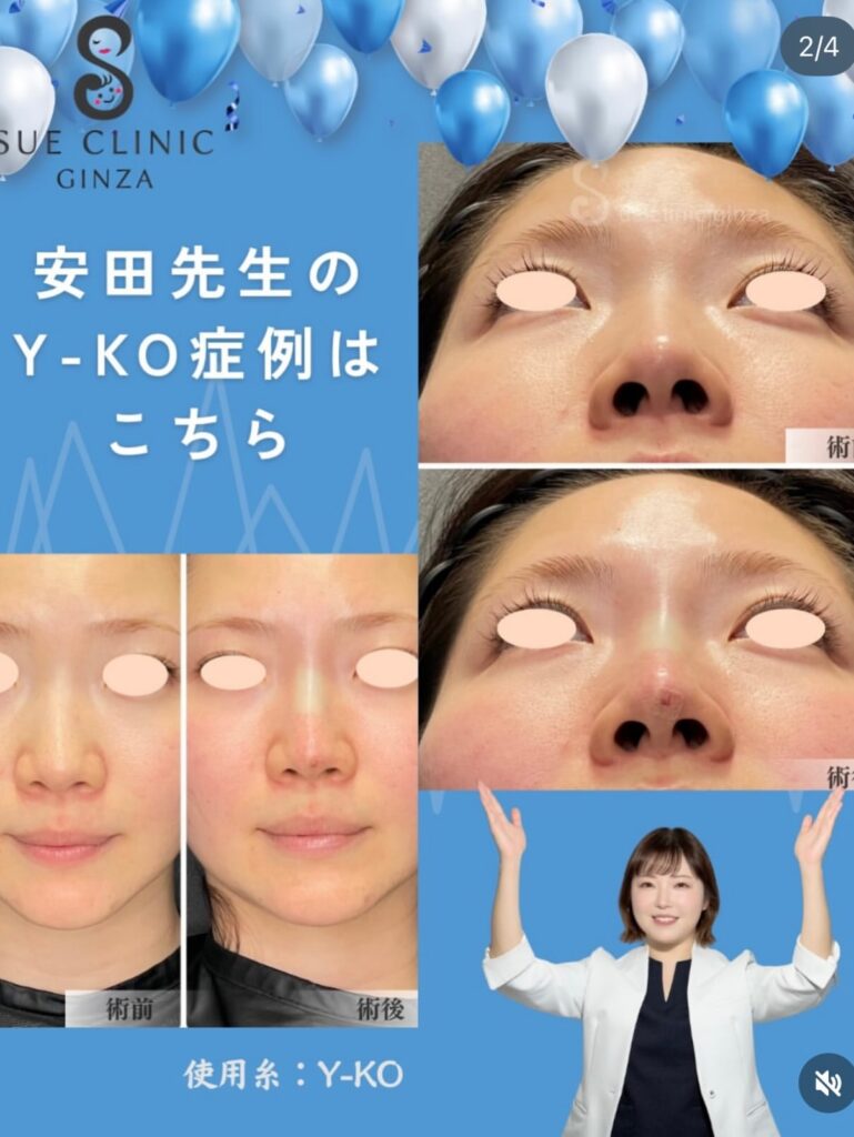 症例