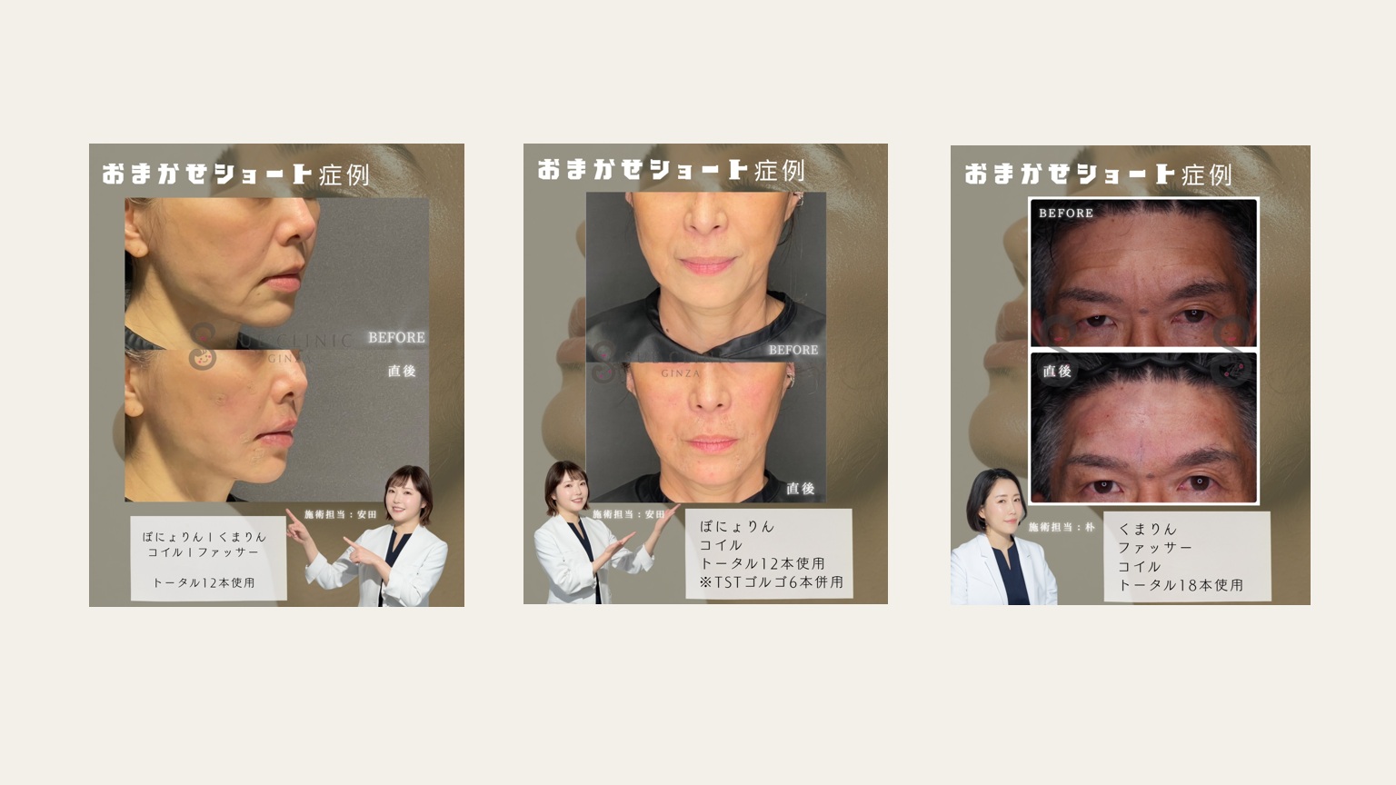 お任せショート症例
